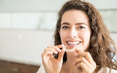 Things to know about Invisalign
