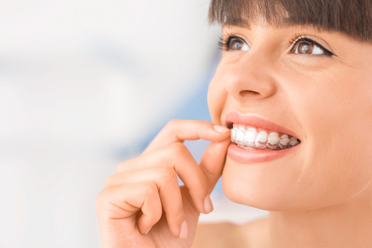 What are Invisalign braces? Dr. Kishor's Dentistry