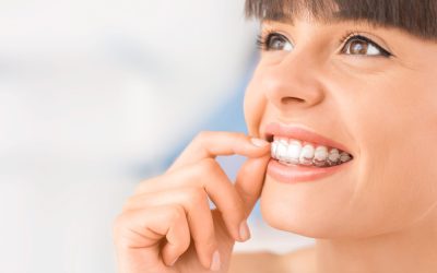 What are Invisalign braces?
