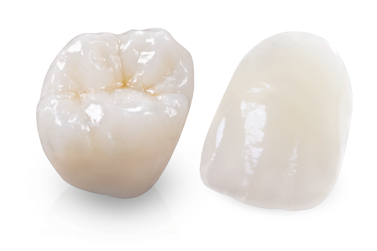 Partial Dentures