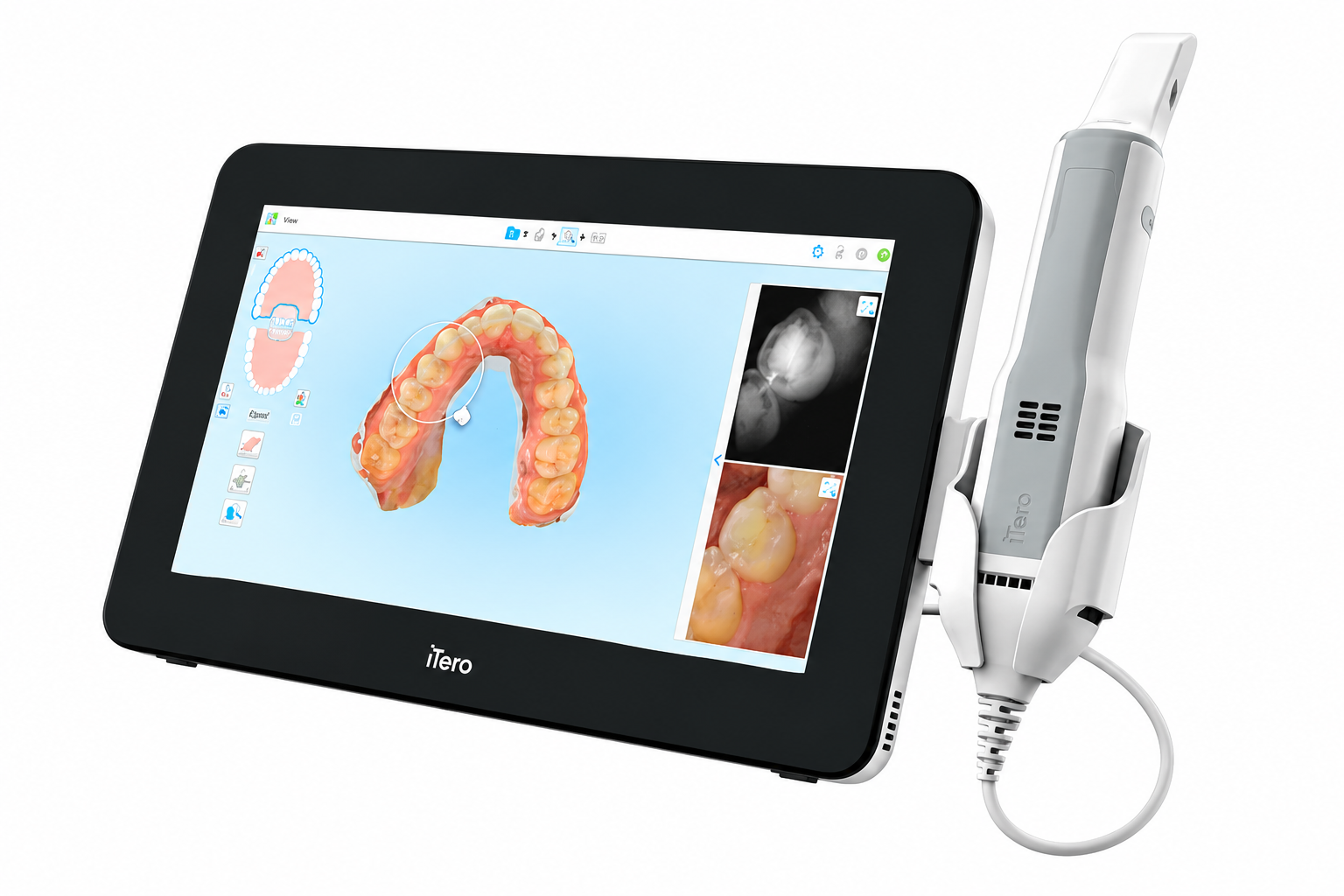 5D - Itero Scanner